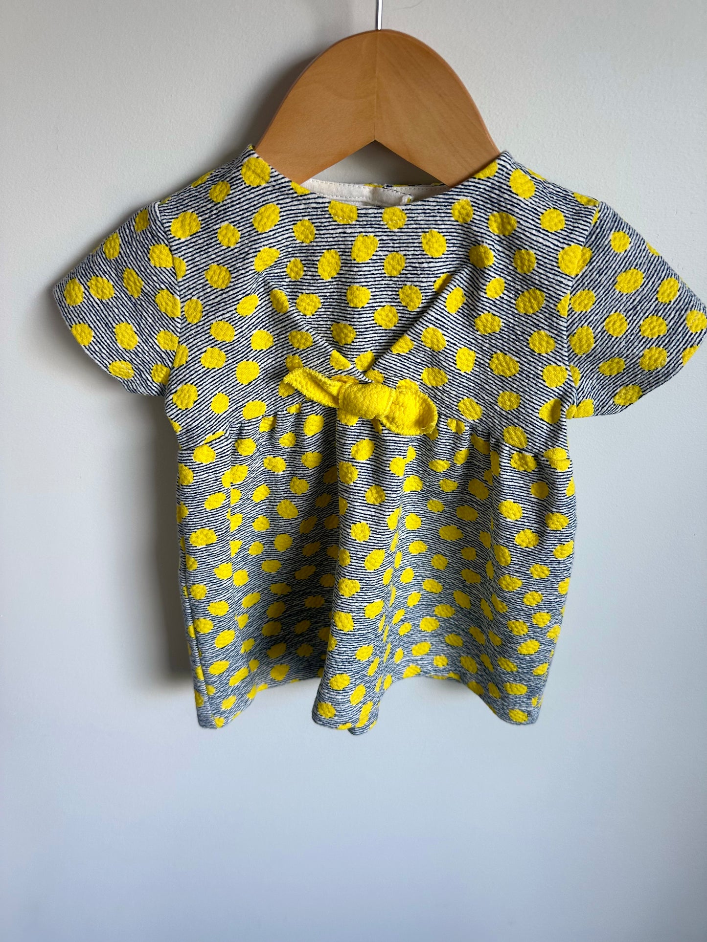 Yellow Dot Striped Dress / 3-6m