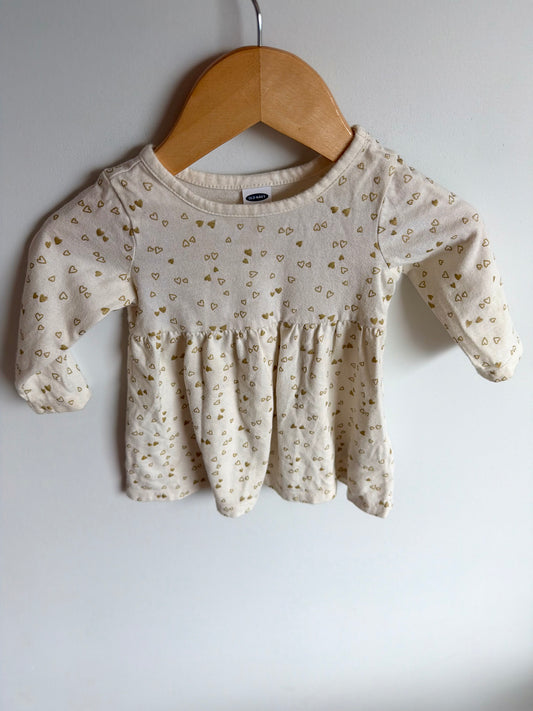 Gold Heart Dress / 3-6m