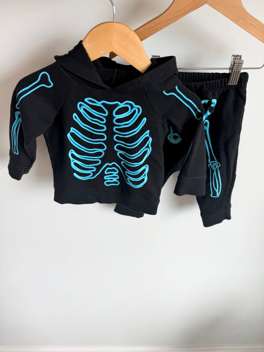 Blue Skeleton Sweater + Pants Set / 6-12m