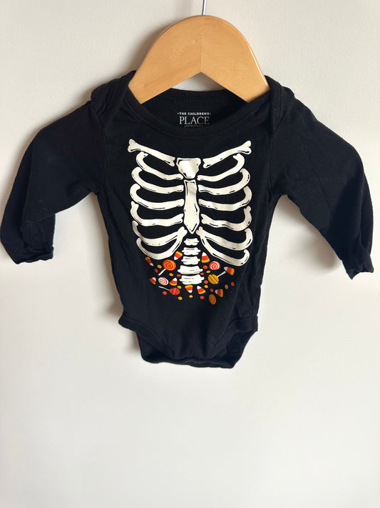 Skeleton + Candy Bodysuit / 3-6m