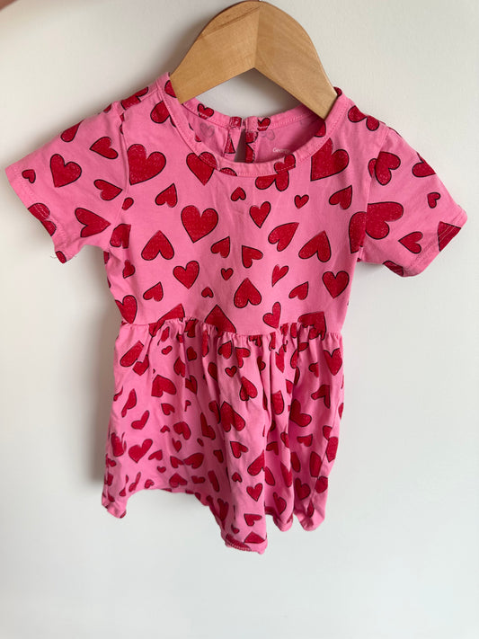 Pink Hearts Dress / 18-24m