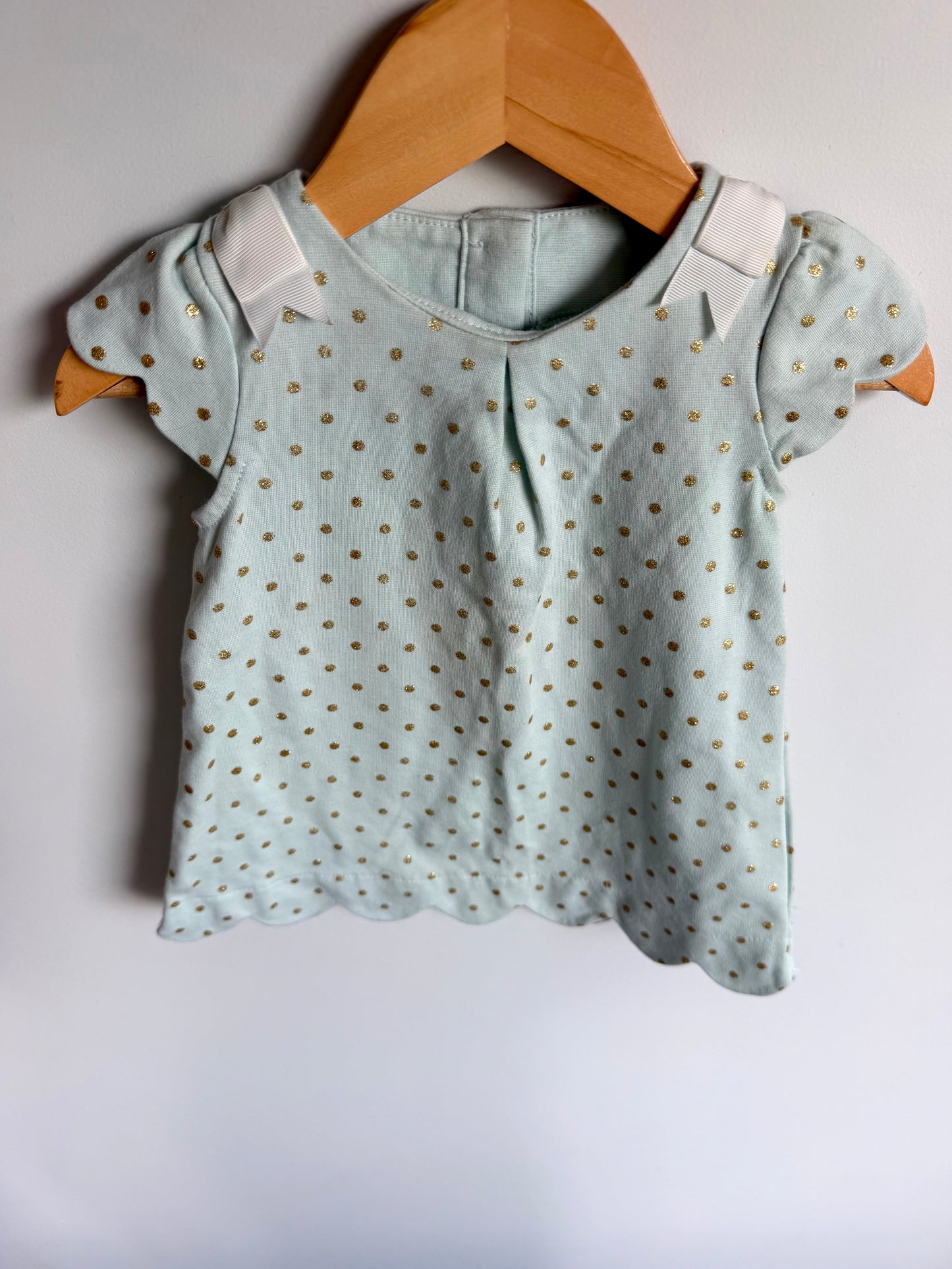 Teal + Gold Dotted Dress / 12-18m