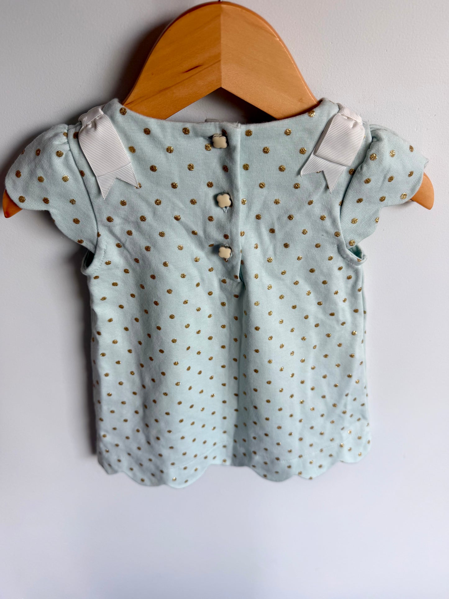 Teal + Gold Dotted Dress / 12-18m