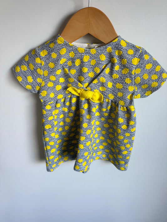 Yellow Dot Striped Dress / 3-6m