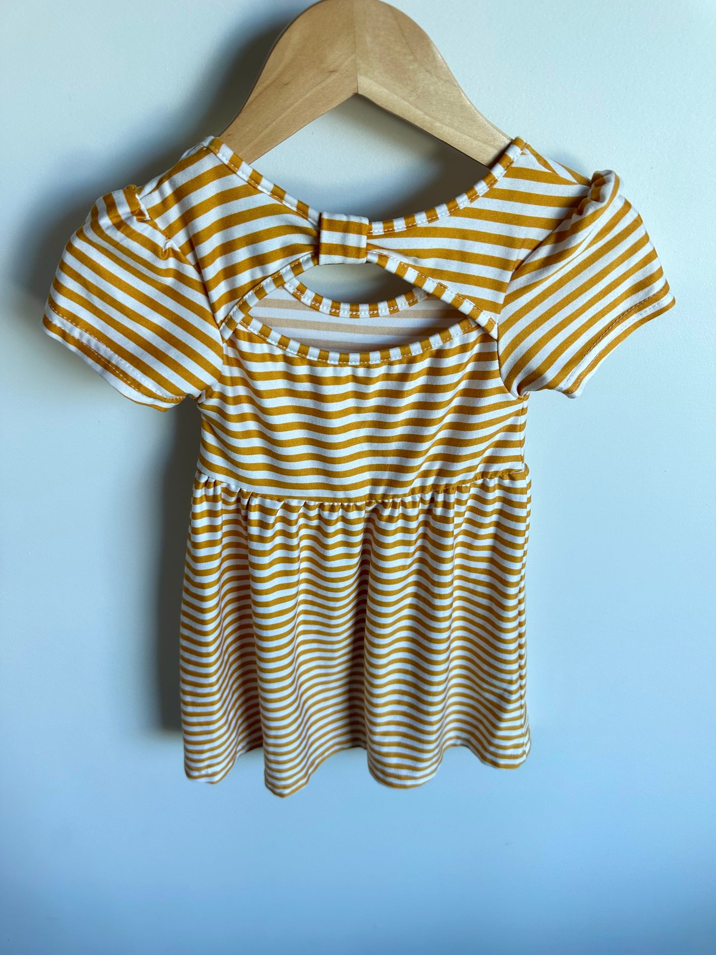 Yellow Striped Dress / 12m