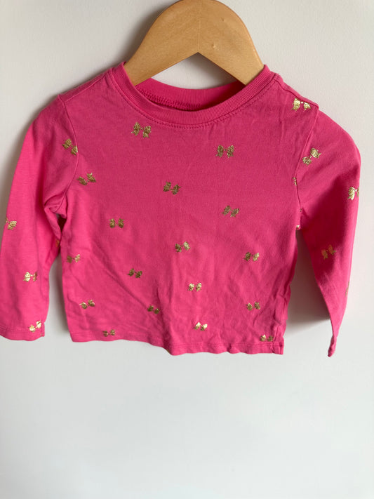 Pink Top with Gold Bows / 2T