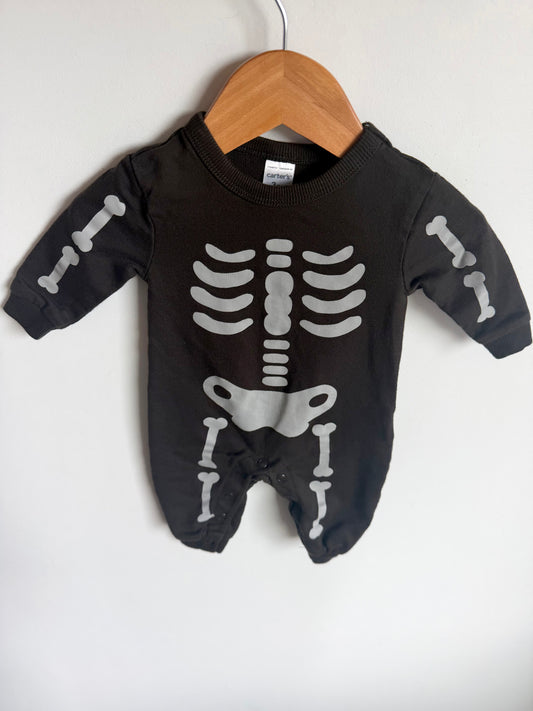 Skeleton Cotton Jumpsuit / 3m